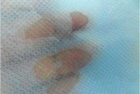 Hydrophilic non-woven fabric